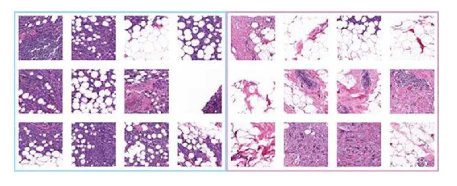 Medical Image Unlearning